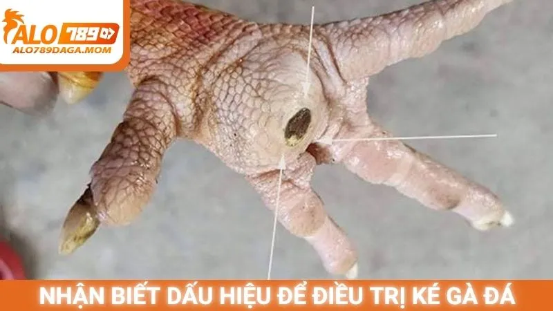 Nhận biết dấu hiệu để điều trị ké gà đá