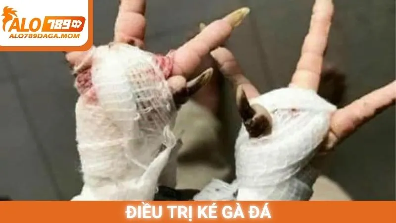 Điều trị ké gà đá